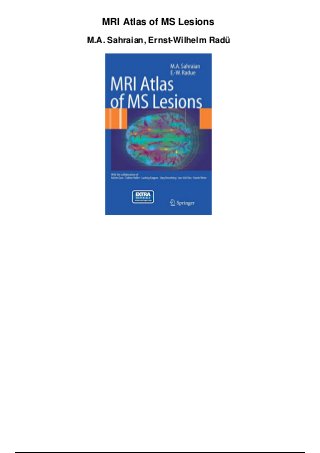 MRI Atlas of MS Lesions
M.A. Sahraian, Ernst-Wilhelm Radü
 
