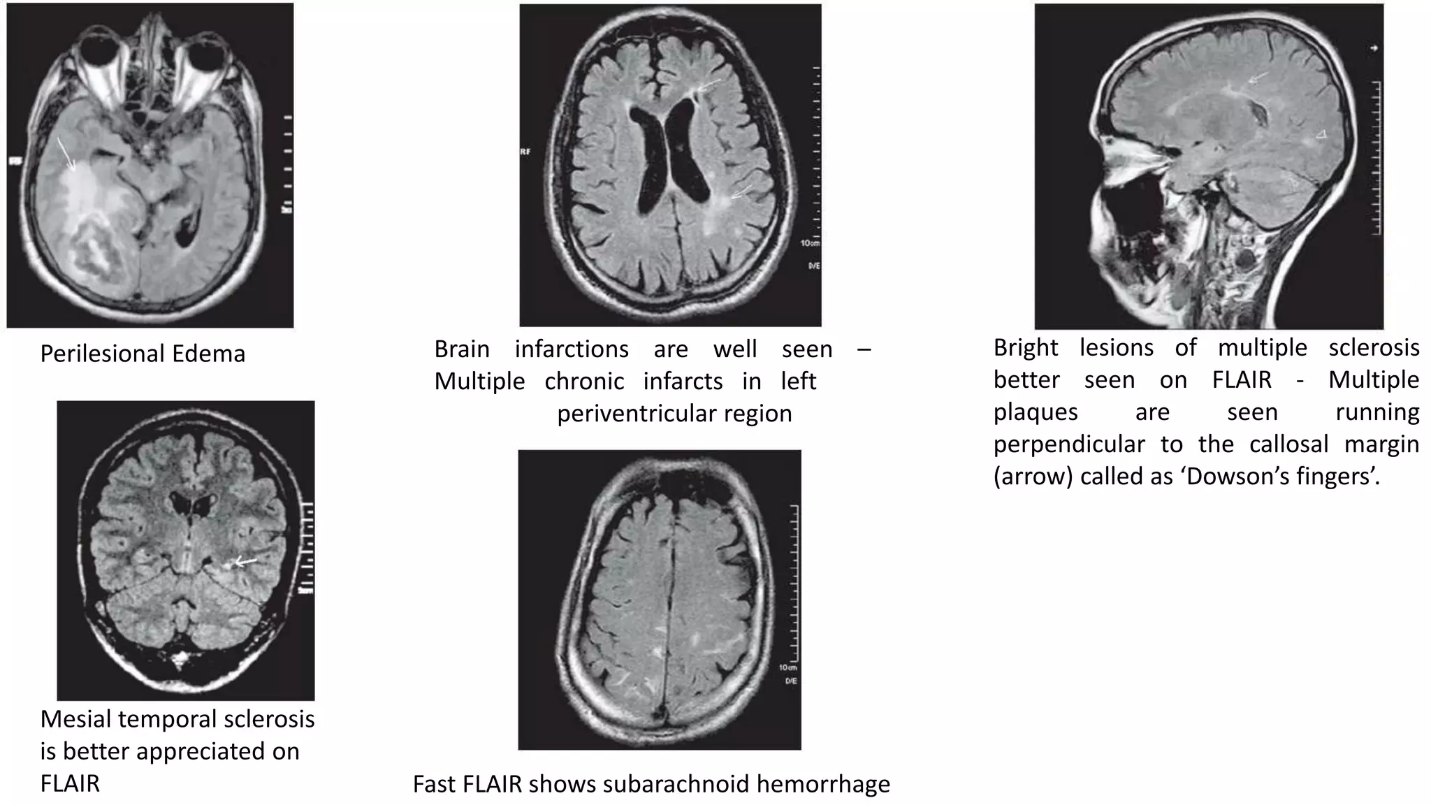 Mri basic principles | PPTX
