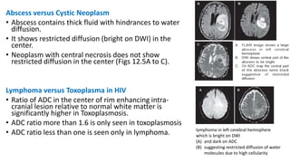 Mri basic principles | PPTX