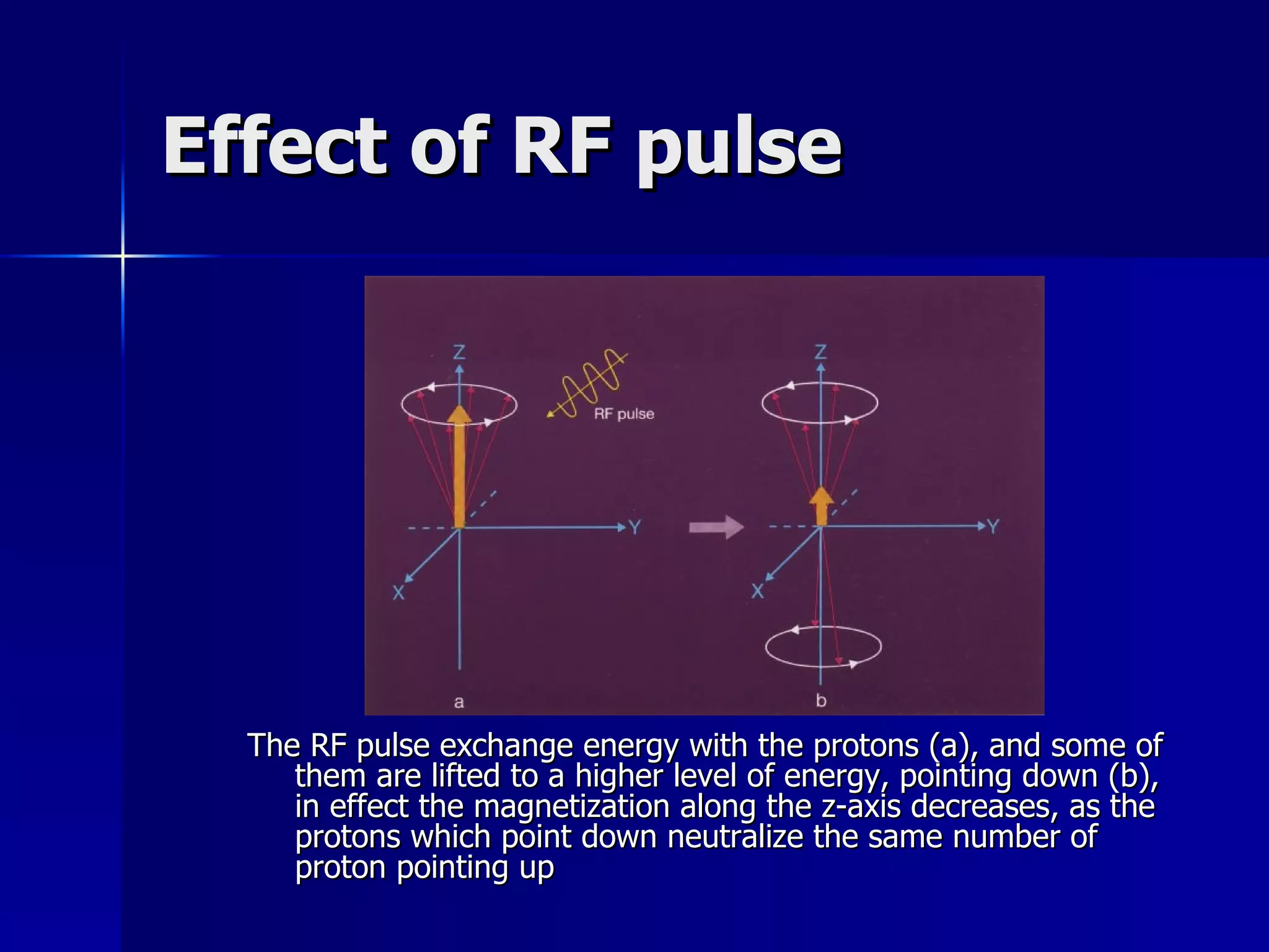Effect of RF pulse The RF pulse exchange energy with the protons (a), and some of them are lifted to a higher level of energy, pointing down (b), in effect the magnetization along the z-axis decreases, as the protons which point down neutralize the same number of proton pointing up 