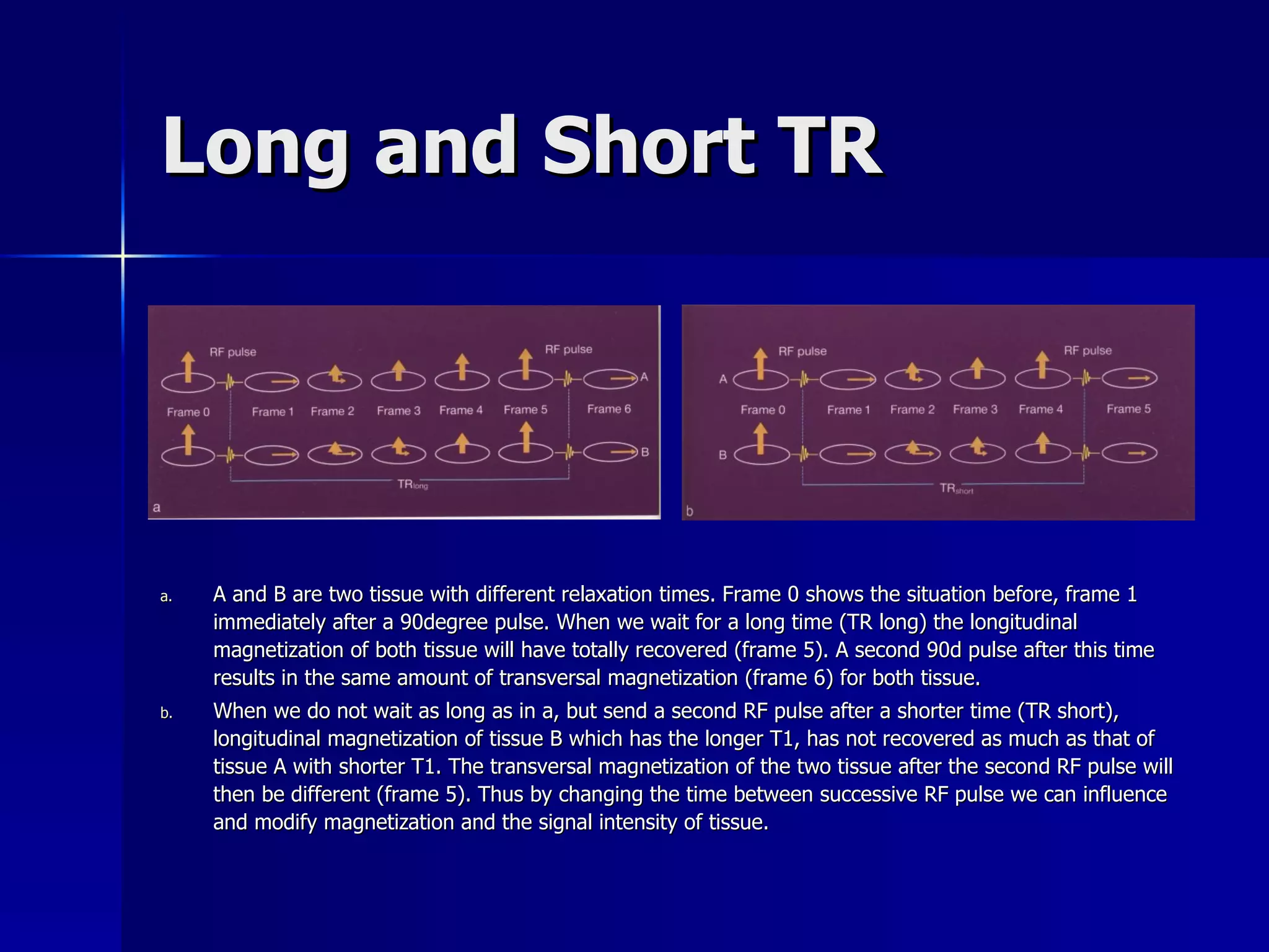Long and Short TR A and B are two tissue with different relaxation times. Frame 0 shows the situation before, frame 1 immediately after a 90degree pulse. When we wait for a long time (TR long) the longitudinal magnetization of both tissue will have totally recovered (frame 5). A second 90d pulse after this time results in the same amount of transversal magnetization (frame 6) for both tissue. When we do not wait as long as in a, but send a second RF pulse after a shorter time (TR short), longitudinal magnetization of tissue B which has the longer T1, has not recovered as much as that of tissue A with shorter T1. The transversal magnetization of the two tissue after the second RF pulse will then be different (frame 5). Thus by changing the time between successive RF pulse we can influence and modify magnetization and the signal intensity of tissue. 