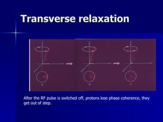 Transverse relaxation After the RF pulse is switched off, protons lose phase coherence, they get out of step.  