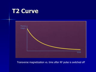 T2 Curve Transverse magnetization vs. time after RF pulse is switched off  