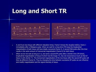 Long and Short TR A and B are two tissue with different relaxation times. Frame 0 shows the situation before, frame 1 immediately after a 90degree pulse. When we wait for a long time (TR long) the longitudinal magnetization of both tissue will have totally recovered (frame 5). A second 90d pulse after this time results in the same amount of transversal magnetization (frame 6) for both tissue. When we do not wait as long as in a, but send a second RF pulse after a shorter time (TR short), longitudinal magnetization of tissue B which has the longer T1, has not recovered as much as that of tissue A with shorter T1. The transversal magnetization of the two tissue after the second RF pulse will then be different (frame 5). Thus by changing the time between successive RF pulse we can influence and modify magnetization and the signal intensity of tissue. 