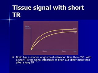 Tissue signal with short TR Brain has a shorter longitudinal relaxation time than CSF. With a short TR the signal intensities of brain CSF differ more than after a long TR 