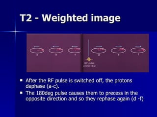 T2 - Weighted image After the RF pulse is switched off, the protons dephase (a-c).  The 180deg pulse causes them to precess in the opposite direction and so they rephase again (d -f) 