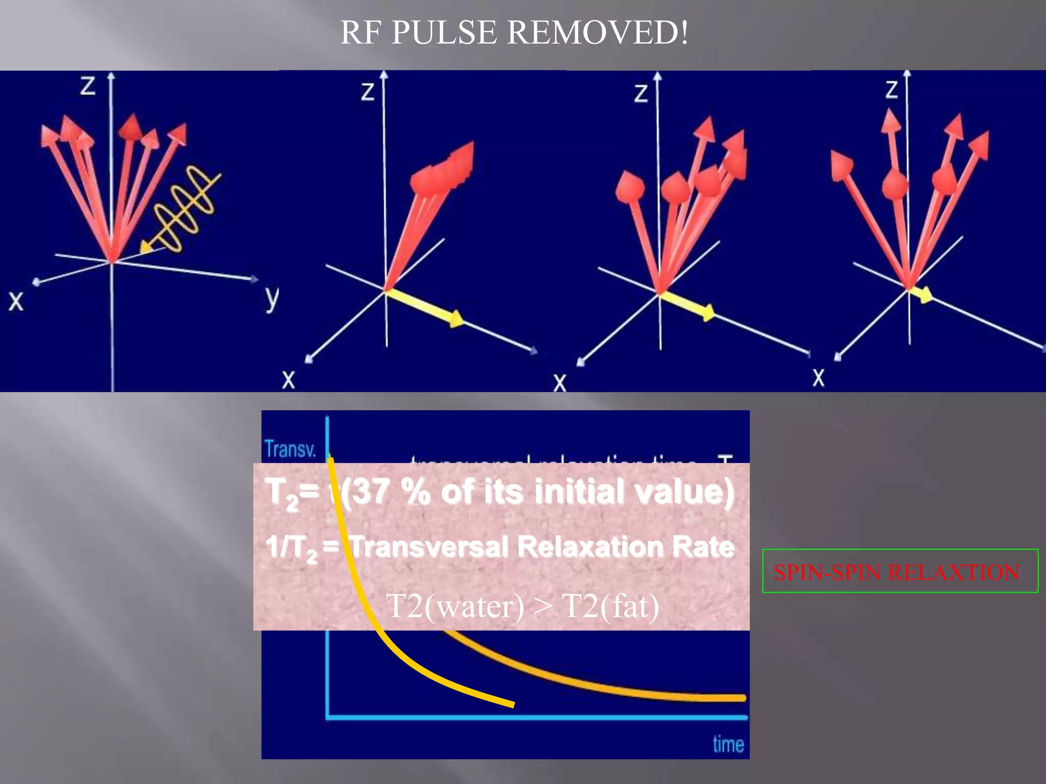 T2= t(37 % of its initial value)
1/T2 = Transversal Relaxation Rate
T2(water) > T2(fat)
RF PULSE REMOVED!
SPIN-SPIN RELAXTION
 
