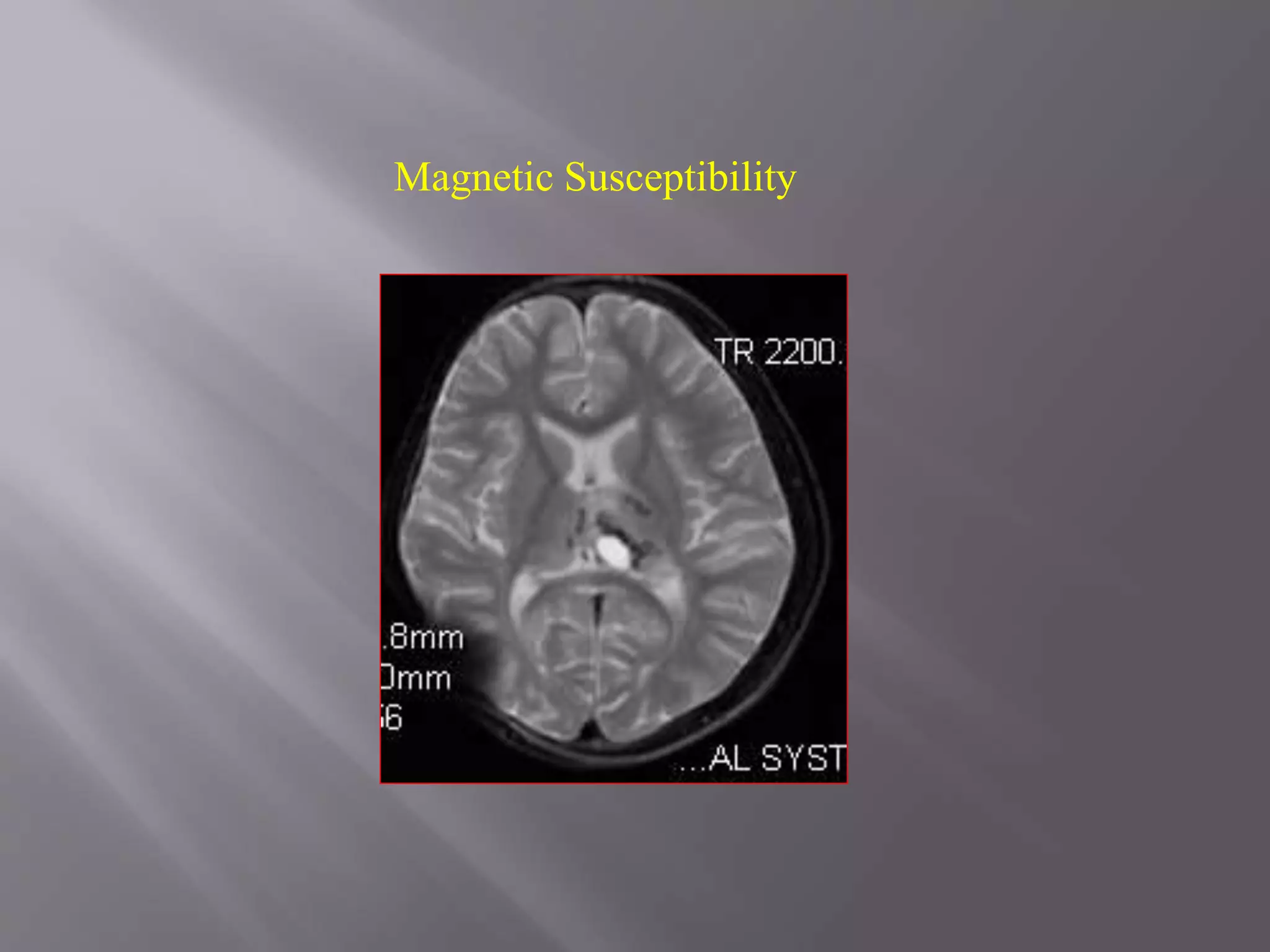 Magnetic Susceptibility
 
