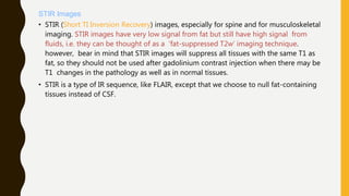 STIR Images
• STIR (Short TI Inversion Recovery) images, especially for spine and for musculoskeletal
imaging. STIR images have very low signal from fat but still have high signal from
fluids, i.e. they can be thought of as a ‘fat-suppressed T2w’ imaging technique.
however, bear in mind that STIR images will suppress all tissues with the same T1 as
fat, so they should not be used after gadolinium contrast injection when there may be
T1 changes in the pathology as well as in normal tissues.
• STIR is a type of IR sequence, like FLAIR, except that we choose to null fat-containing
tissues instead of CSF.
 