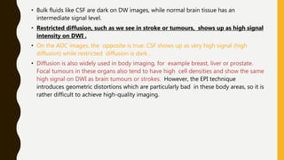 • Bulk fluids like CSF are dark on DW images, while normal brain tissue has an
intermediate signal level.
• Restricted diffusion, such as we see in stroke or tumours, shows up as high signal
intensity on DWI .
• On the ADC images, the opposite is true: CSF shows up as very high signal (high
diffusion) while restricted diffusion is dark .
• Diffusion is also widely used in body imaging, for example breast, liver or prostate.
Focal tumours in these organs also tend to have high cell densities and show the same
high signal on DWI as brain tumours or strokes. However, the EPI technique
introduces geometric distortions which are particularly bad in these body areas, so it is
rather difficult to achieve high-quality imaging.
 