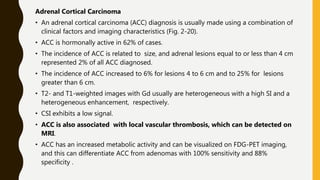 Adrenal Cortical Carcinoma
• An adrenal cortical carcinoma (ACC) diagnosis is usually made using a combination of
clinical factors and imaging characteristics (Fig. 2-20).
• ACC is hormonally active in 62% of cases.
• The incidence of ACC is related to size, and adrenal lesions equal to or less than 4 cm
represented 2% of all ACC diagnosed.
• The incidence of ACC increased to 6% for lesions 4 to 6 cm and to 25% for lesions
greater than 6 cm.
• T2- and T1-weighted images with Gd usually are heterogeneous with a high SI and a
heterogeneous enhancement, respectively.
• CSI exhibits a low signal.
• ACC is also associated with local vascular thrombosis, which can be detected on
MRI.
• ACC has an increased metabolic activity and can be visualized on FDG-PET imaging,
and this can differentiate ACC from adenomas with 100% sensitivity and 88%
specificity .
 