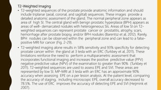 T2-Weighted Imaging
• T2-weighted sequences of the prostate provide anatomic information and should
include triplanar (axial, coronal, and sagittal) sequences. These images provide a
detailed anatomic assessment of the gland. The normal peripheral zone appears as
area of high SI. The central gland with benign prostatic hyperplasia (BPH) appears as
areas of well- demarcated nodules with heterogeneous SIs. Areas of low SI on T2-
weighted sequences can represent prostate cancer or prostatitis, atrophy, scars,
hemorrhage after prostate biopsy, and/or BPH nodules (Barentsz et al, 2012). Rarely,
BPH nodules can be observed within the peripheral zone and can lead to a false-
positive MRI for cancer (Fig. 2-29).
• T2-weighted imaging alone results in 58% sensitivity and 93% specificity for detecting
prostate cancer within the gland at 3 tesla with an ERC (Turkbey et al, 2011). These
limitations reinforce the need to perform a multiparametric assessment that
incorporates functional imaging and increases the positive predictive value (PPV)
negative predictive value (NPV) of the examination to greater than 90% (Turkbey et
2011). T2-weighted sequences are used to assess EPE and SVI. These areas are
represented by low SI. MP-MRI at 3 tesla with an ERC has an approximate 90%
accuracy when assessing EPE on a per lesion analysis. At the patient level, comparing
the accuracy of staging, including microscopic EPE, overall accuracy decreased to
78.5%. The use of ERC improves the accuracy of detecting EPE and SVI (Heijmink et
2007).
 