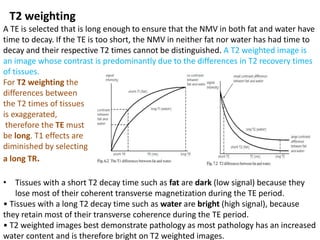T2 weighting
A TE is selected that is long enough to ensure that the NMV in both fat and water have
time to decay. If the TE is too short, the NMV in neither fat nor water has had time to
decay and their respective T2 times cannot be distinguished. A T2 weighted image is
an image whose contrast is predominantly due to the differences in T2 recovery times
of tissues.
For T2 weighting the
differences between
the T2 times of tissues
is exaggerated,
therefore the TE must
be long. T1 effects are
diminished by selecting
a long TR.
• Tissues with a short T2 decay time such as fat are dark (low signal) because they
lose most of their coherent transverse magnetization during the TE period.
• Tissues with a long T2 decay time such as water are bright (high signal), because
they retain most of their transverse coherence during the TE period.
• T2 weighted images best demonstrate pathology as most pathology has an increased
water content and is therefore bright on T2 weighted images.
 