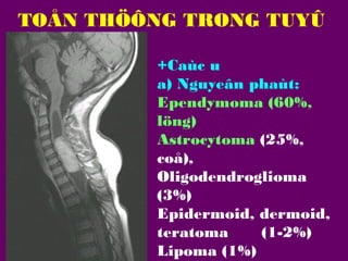 TOÅN THÖÔNG TRONG TUYÛ
SOÁNG
+Caùc u
a) Nguyeân phaùt:
Ependymoma (60%,
löng)
Astrocytoma (25%,
coå),
Oligodendroglioma
(3%)
Epidermoid, dermoid,
teratoma
(1-2%)
Lipoma (1%)

 