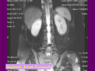 Sagittal, Axial, Coronal

 