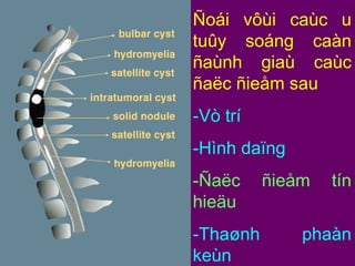 Ñoái vôùi caùc u
tuûy soáng caàn
ñaùnh giaù caùc
ñaëc ñieåm sau
-Vò trí
-Hình daïng
-Ñaëc
hieäu
-Thaønh
keùn

ñieåm

tín

phaàn

 