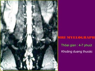 MRI MYELOGRAPHY
Thôøi gian : 4-7 phuùt
Khoâng duøng thuoác

 