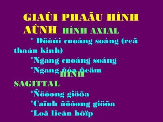 GIAÛI PHAÃU HÌNH
AÛNH HÌNH AXIAL

* Döôùi cuoáng soáng (reã
thaàn kinh)
*Ngang cuoáng soáng
*Ngang ñóa ñeäm
HÌNH
SAGITTAL
*Ñöôøng giöõa
*Caïnh ñöôøng giöõa
*Loã lieân hôïp

 