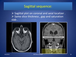 Sagittal sequence:
 Sagittal plot on coronal and axial localizer .
 Same slice thickness , gap and saturation
slab .
9/3/2013 29MRI Brain by Sudil
 