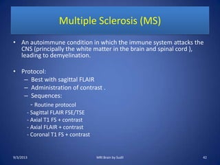 Multiple Sclerosis (MS)
• An autoimmune condition in which the immune system attacks the
CNS (principally the white matter in the brain and spinal cord ),
leading to demyelination.
• Protocol:
– Best with sagittal FLAIR
– Administration of contrast .
– Sequences:
- Routine protocol
- Sagittal FLAIR FSE/TSE
- Axial T1 FS + contrast
- Axial FLAIR + contrast
- Coronal T1 FS + contrast
9/3/2013 42MRI Brain by Sudil
 
