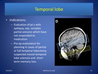 Temporal lobe
• Indications:
– Evaluation of pt.s with
epilepsy, esp. complex
partial seizures which have
not responded to
medication
– Pre op evalutation for
planning in cases of partial
or full temporal lobectomy,
suspected mesial temporal
lobe sclerosis and short
term memory loss.
9/3/2013 55MRI Brain by Sudil
 