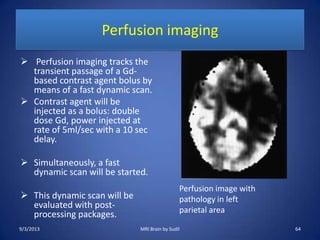 Perfusion imaging
 Perfusion imaging tracks the
transient passage of a Gd-
based contrast agent bolus by
means of a fast dynamic scan.
 Contrast agent will be
injected as a bolus: double
dose Gd, power injected at
rate of 5ml/sec with a 10 sec
delay.
 Simultaneously, a fast
dynamic scan will be started.
 This dynamic scan will be
evaluated with post-
processing packages.
Perfusion image with
pathology in left
parietal area
9/3/2013 64MRI Brain by Sudil
 