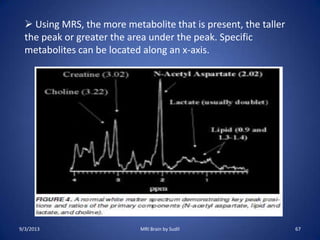  Using MRS, the more metabolite that is present, the taller
the peak or greater the area under the peak. Specific
metabolites can be located along an x-axis.
9/3/2013 67MRI Brain by Sudil
 