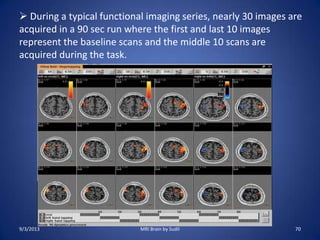  During a typical functional imaging series, nearly 30 images are
acquired in a 90 sec run where the first and last 10 images
represent the baseline scans and the middle 10 scans are
acquired during the task.
9/3/2013 70MRI Brain by Sudil
 