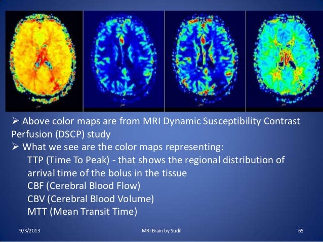 MRI Procedure of Brain
