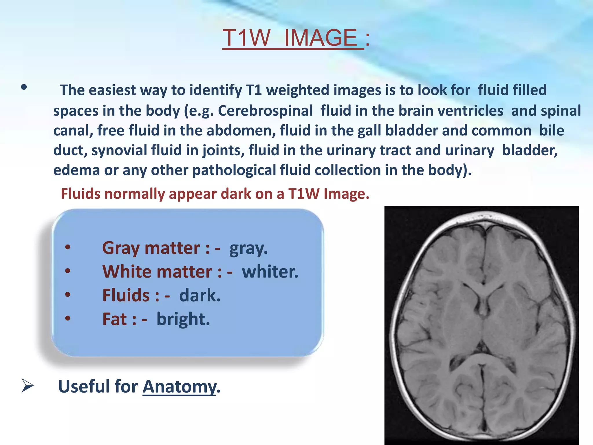 MRI BRAIN(AIIMS DELHI).pptx