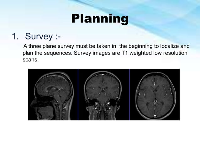 MRI BRAIN(AIIMS DELHI).pptx | Brain and Nervous System Disorders ...