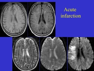 Mri brain anatomy Dr Muhammad Bin Zulfiqar | PPT