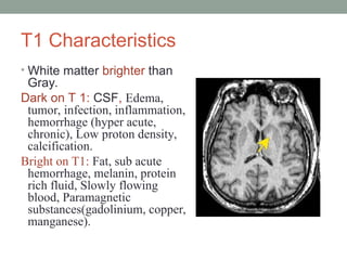 Comprehensive MRI Brain Imaging: Basics and Radiological Anatomy ...