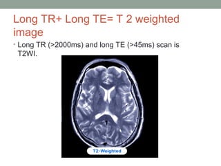 Comprehensive MRI Brain Imaging: Basics and Radiological Anatomy ...