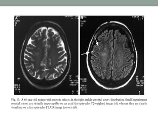 Comprehensive MRI Brain Imaging: Basics and Radiological Anatomy ...