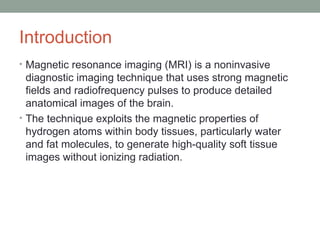 Comprehensive MRI Brain Imaging: Basics and Radiological Anatomy ...