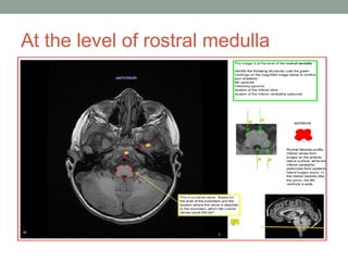 Comprehensive MRI Brain Imaging: Basics and Radiological Anatomy ...