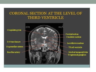 Comprehensive MRI Brain Imaging: Basics and Radiological Anatomy ...