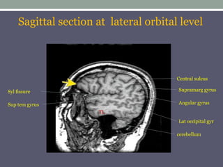 Comprehensive MRI Brain Imaging: Basics and Radiological Anatomy ...