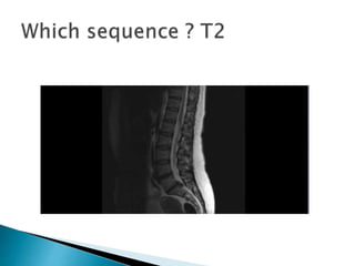 Mri brain imaging | PPTX