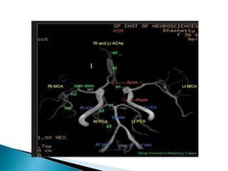 Mri brain imaging | PPTX