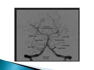 Mri brain imaging | PPTX