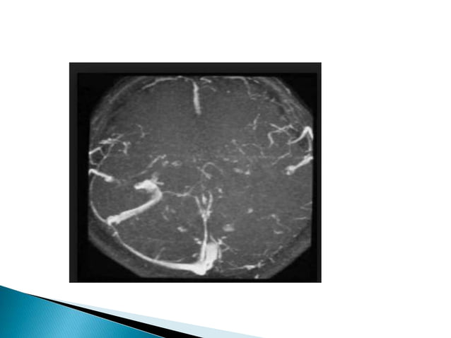 Mri brain imaging | PPTX