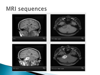 Mri brain imaging | PPT