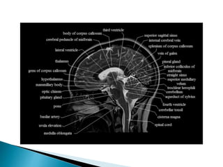 Mri brain imaging | PPTX