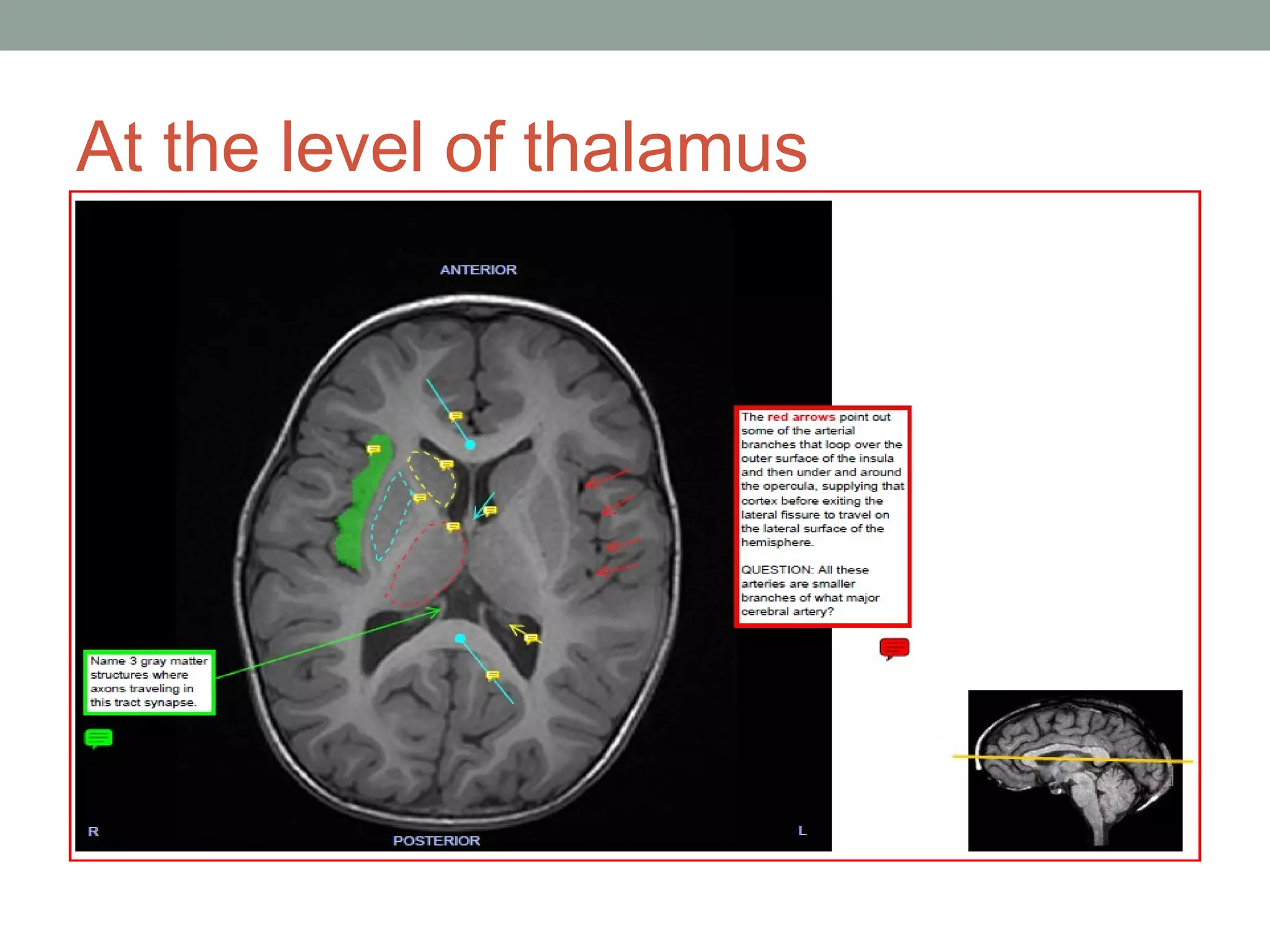 MRI brain; Basics and Radiological Anatomy | PPT