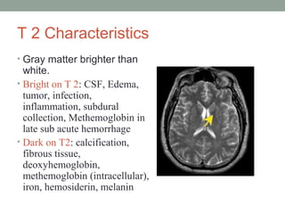T 2 Characteristics
• Gray matter brighter than
white.
• Bright on T 2: CSF, Edema,
tumor, infection,
inflammation, subdural
collection, Methemoglobin in
late sub acute hemorrhage
• Dark on T2: calcification,
fibrous tissue,
deoxyhemoglobin,
methemoglobin (intracellular),
iron, hemosiderin, melanin
 
