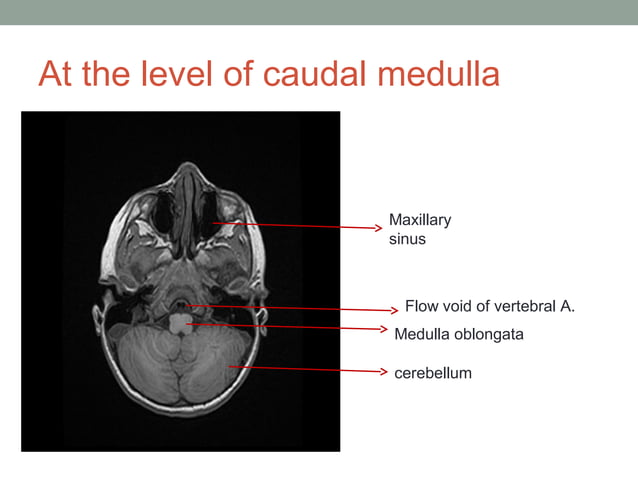 MRI brain; Basics and Radiological Anatomy | PPT | Physics | Science