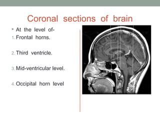 Coronal sections of brain
 At the level of-
1. Frontal horns.
2. Third ventricle.
3. Mid-ventricular level.
4. Occipital horn level
 