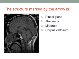 The structure marked by the arrow is?
A. Pineal gland
B. Thalamus
C. Midbrain
D. Corpus callosum
 